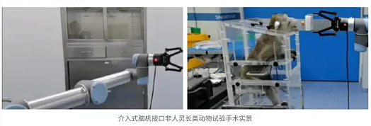 新一代介入式脑机接口研究